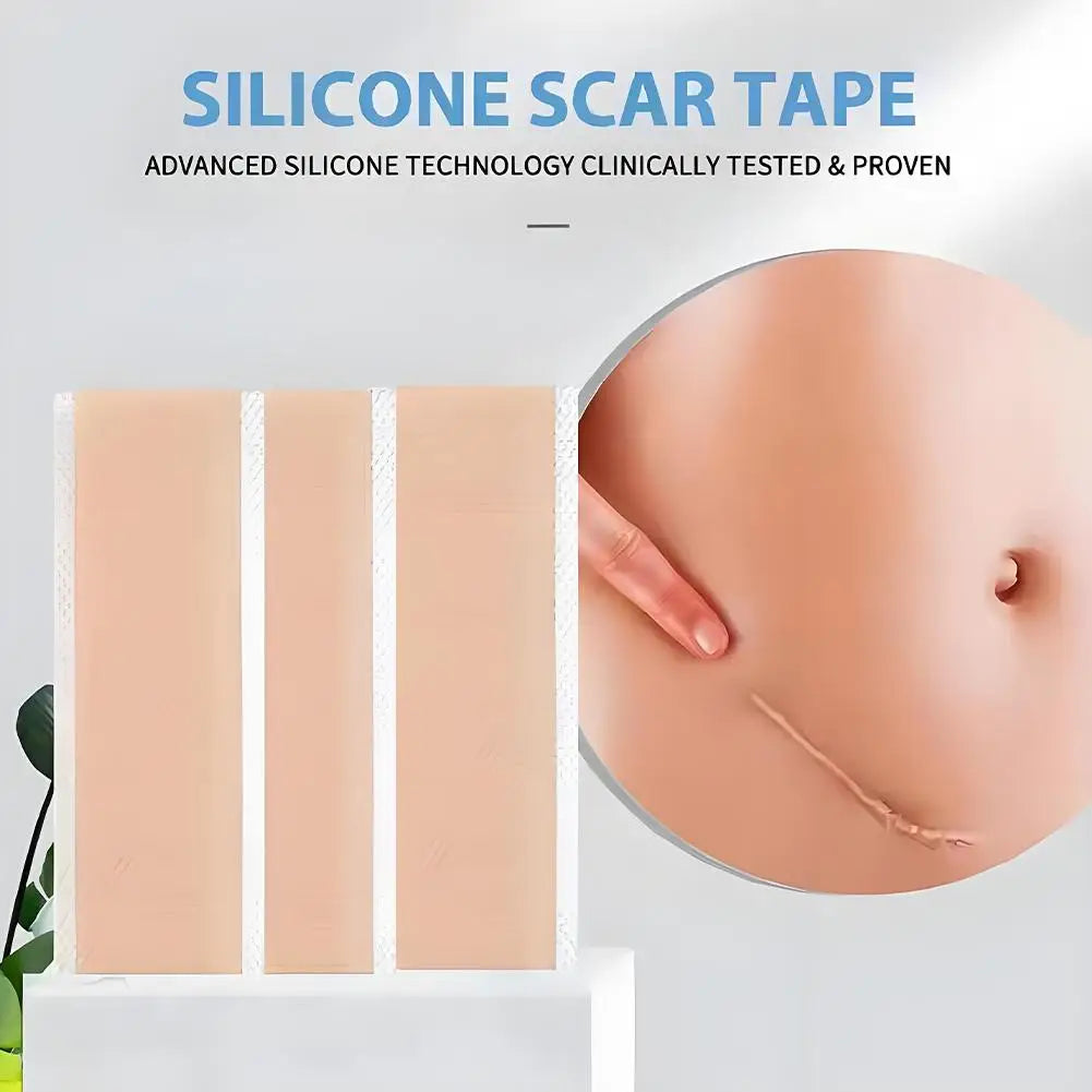 ScarEase Silicone Recovery Tape